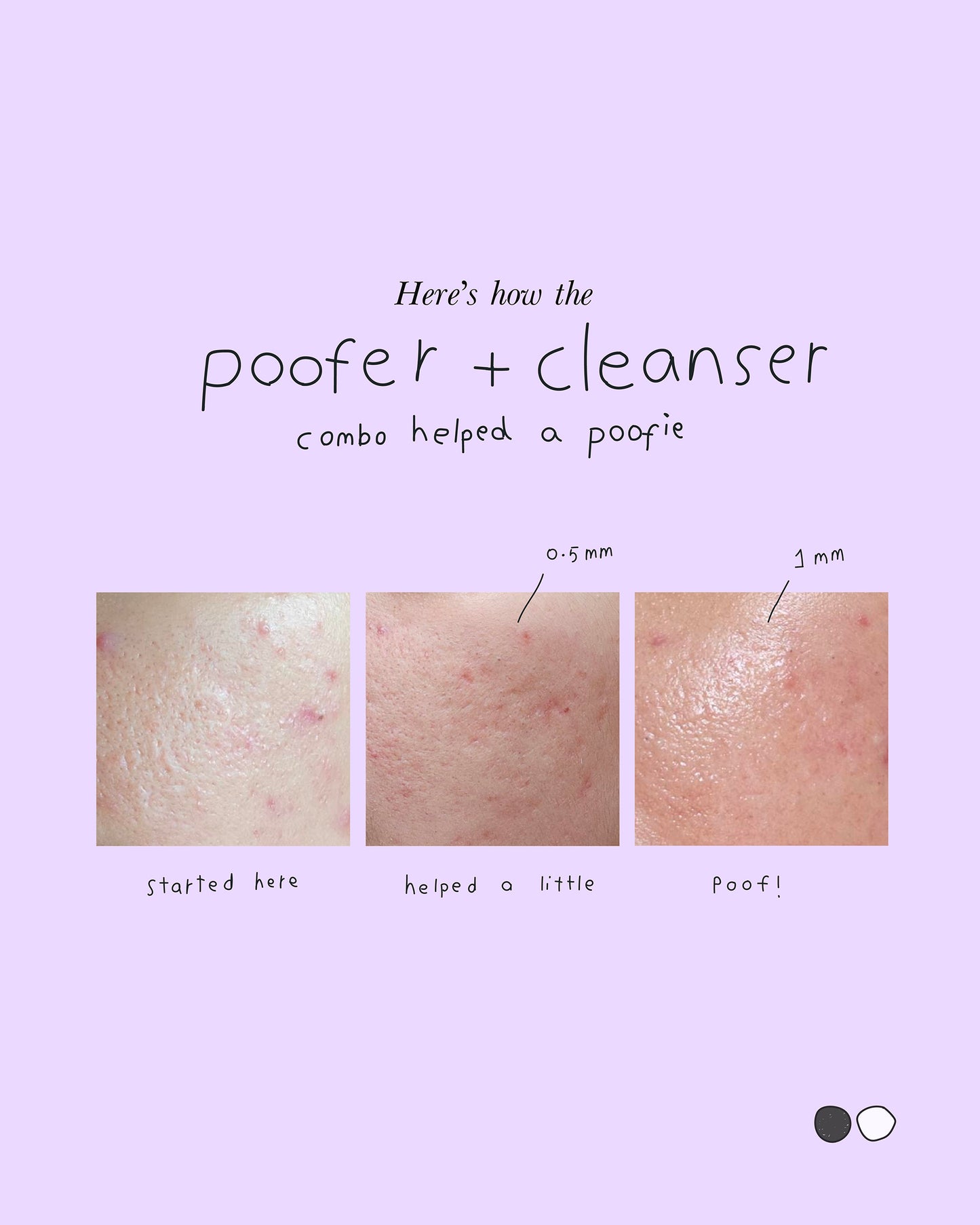 Poofer+