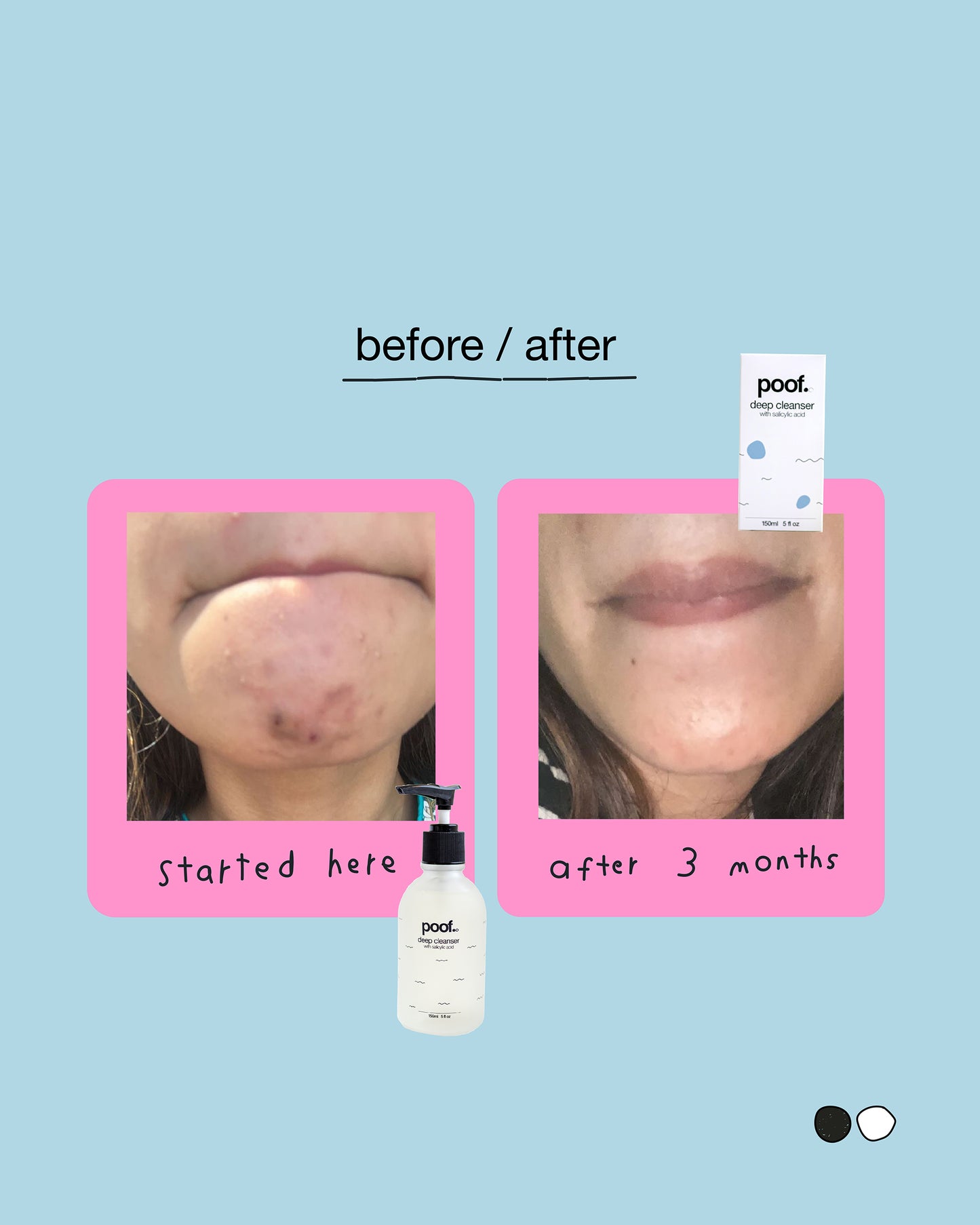 Deep Cleanser w/ Salicylic Acid