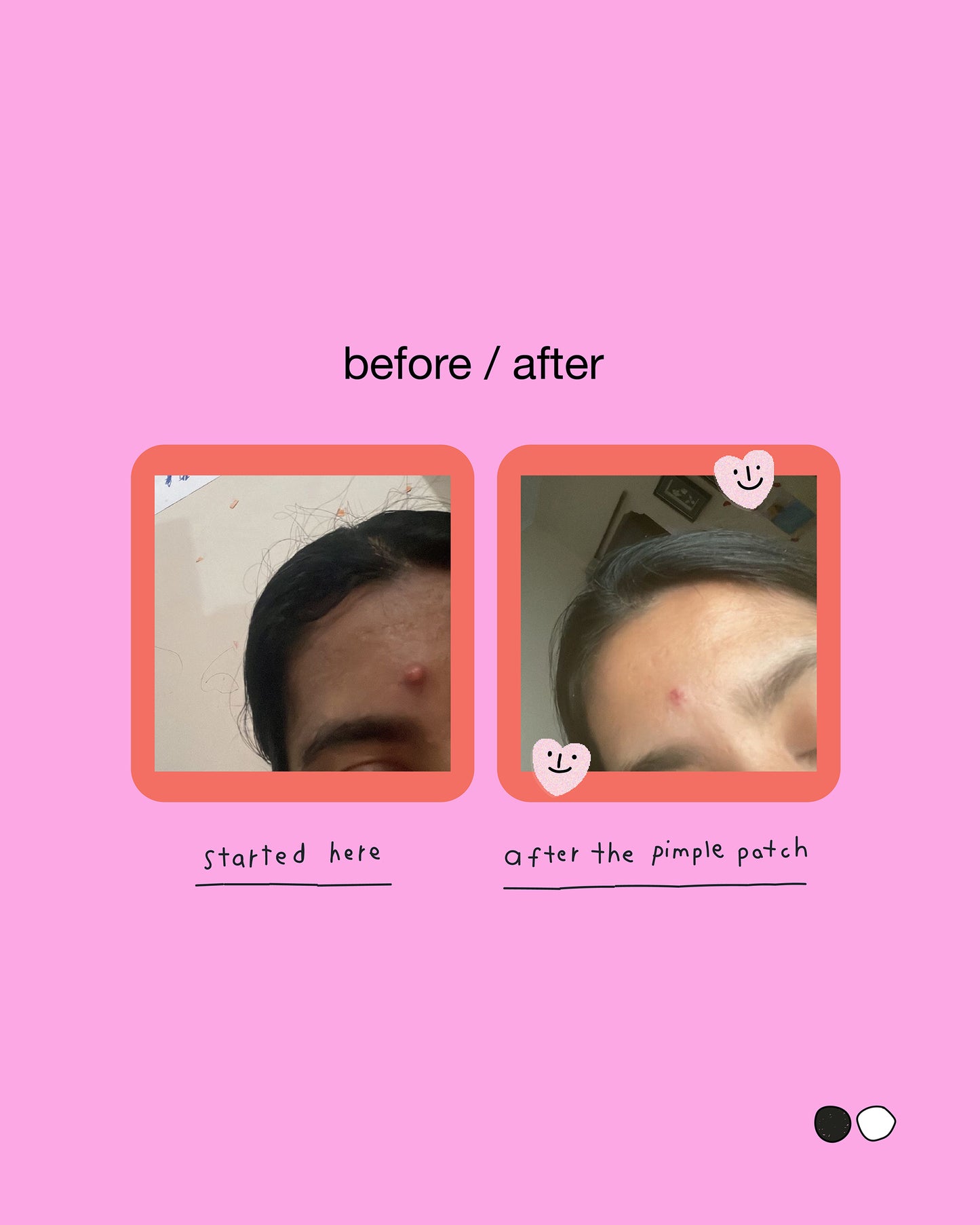 Acne Hearts