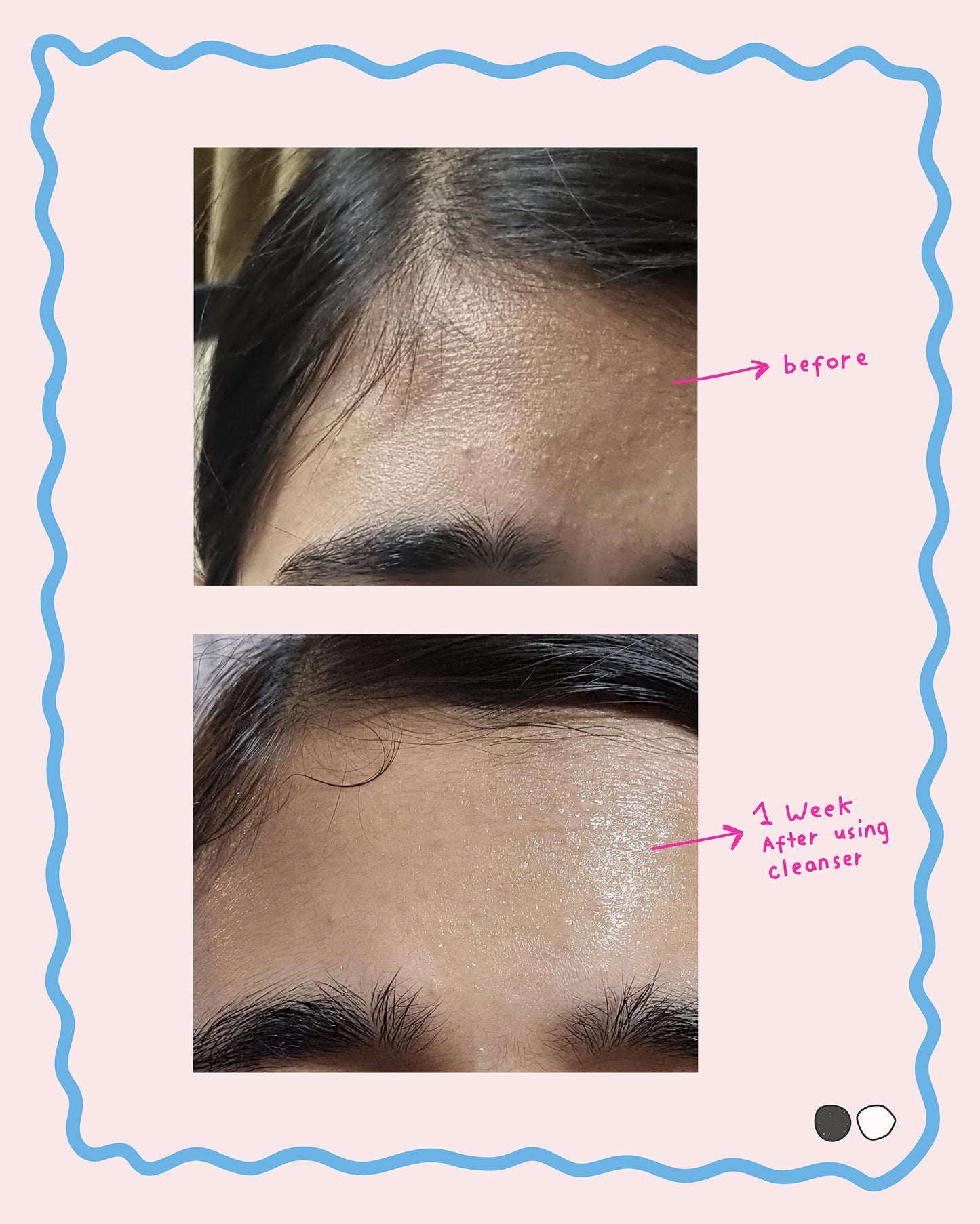 Deep Cleanser w/ Salicylic Acid