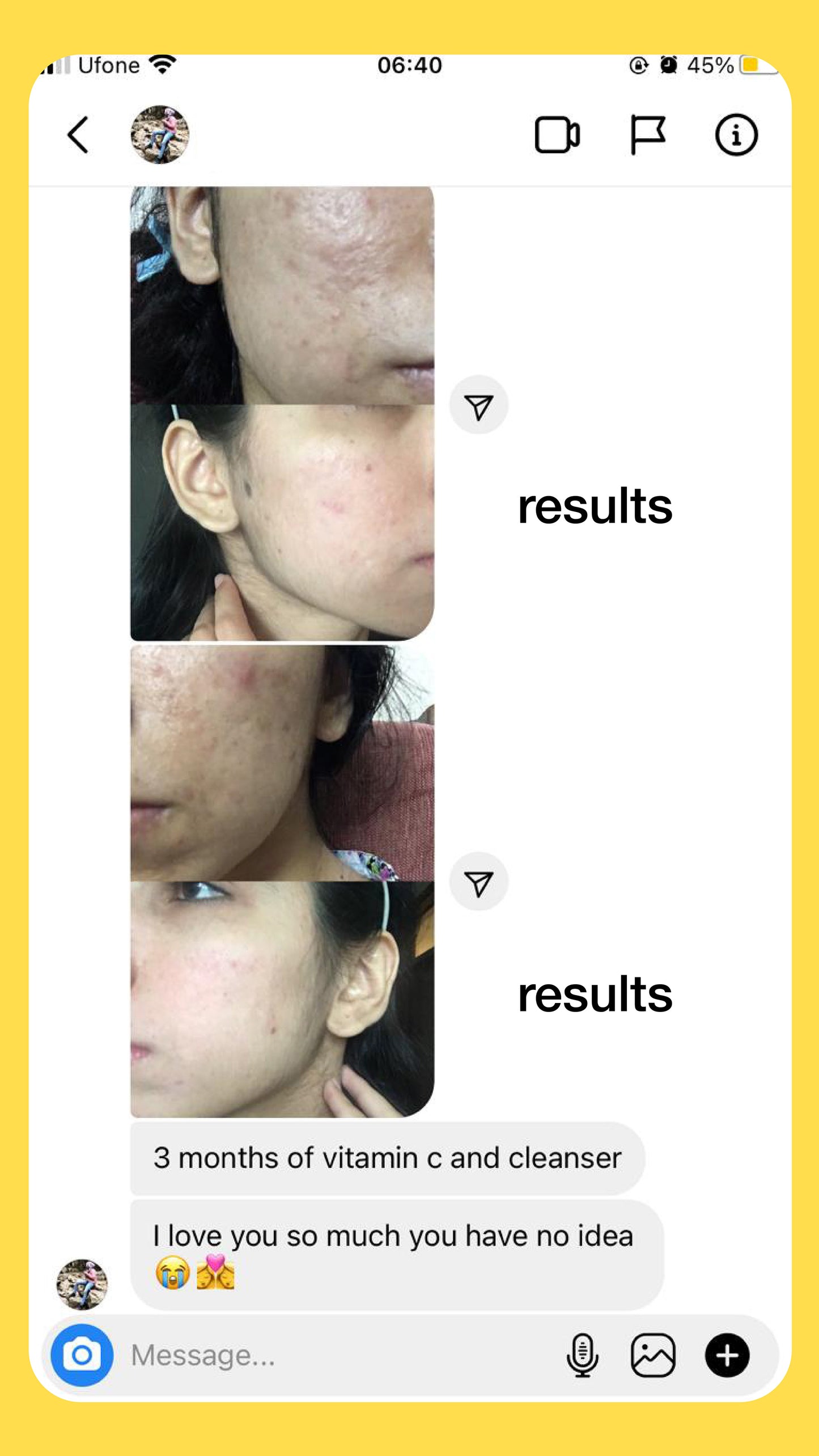 Vitamin C Serum